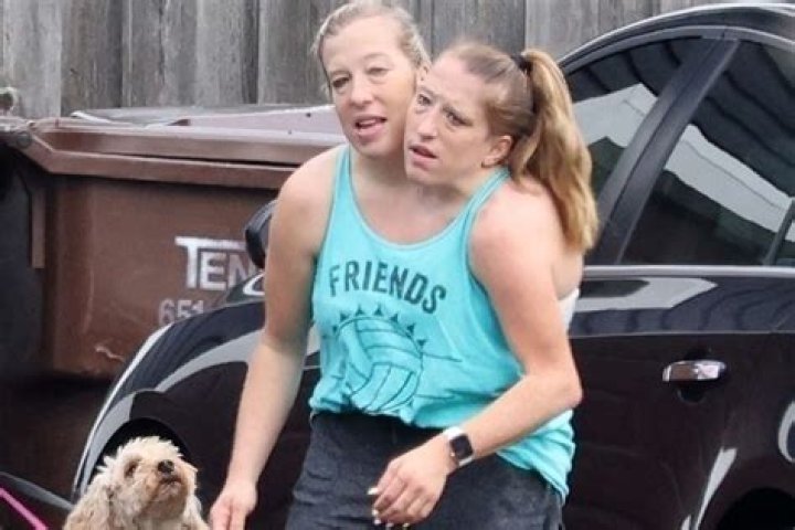 Abby And Brittany Hensel: A Journey Through Challenges And Sad News