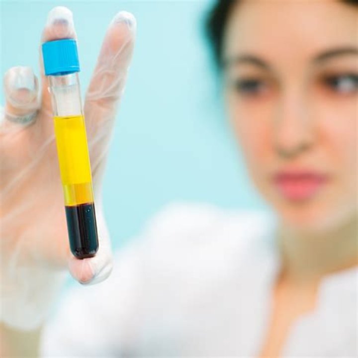 At risk for Alzheimer’s disease? 2 new blood tests could detect it early – here’s how they do it