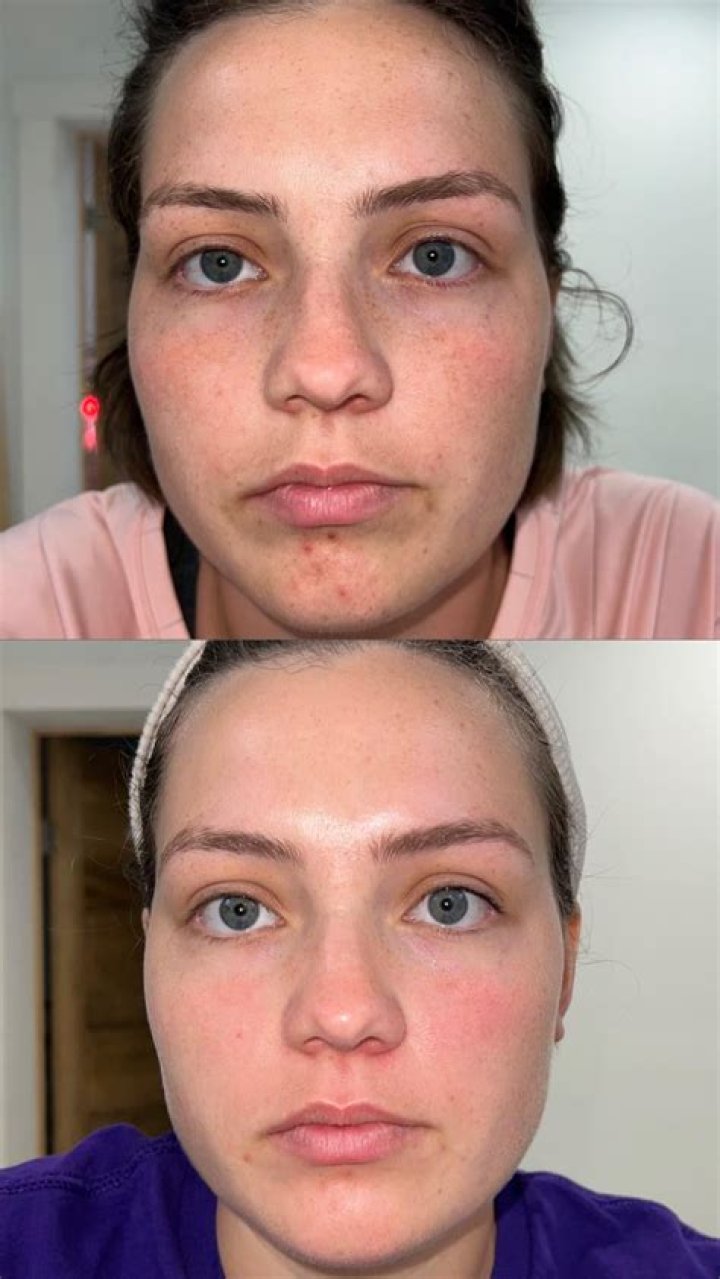 Before and after the mask
