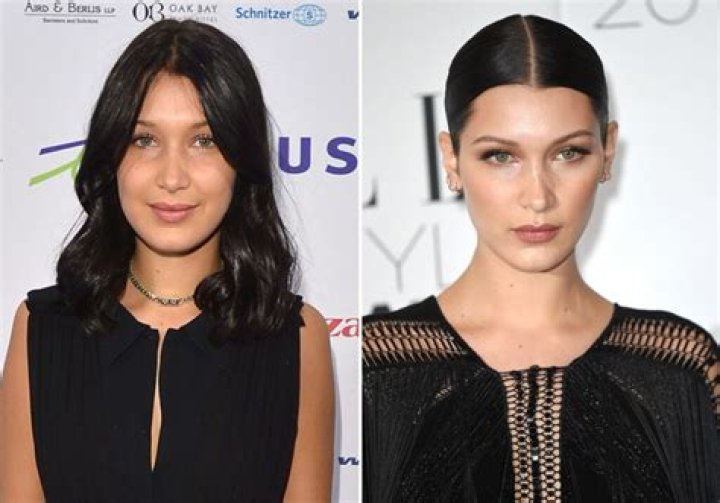Bella Hadid Avant Chirurgie