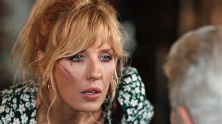 Beth Dutton Face Injury: The Truth Behind The Real Incident