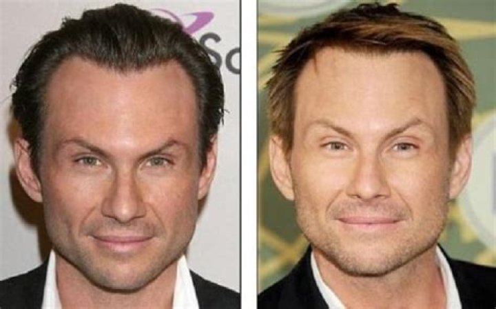 Christian Slater's Plastic Surgery Transformation: A Journey Of Enhancement And Change