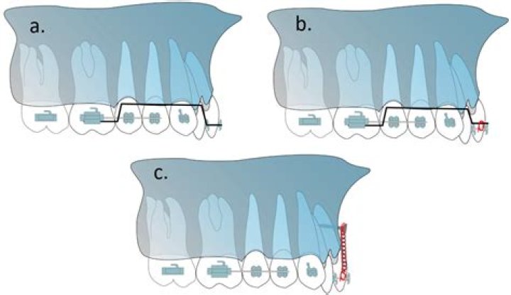 Collapse of dental case leads to records shake-up