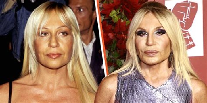 	DANIA WOMAN DIES A DAY AFTER COSMETIC SURGERY	