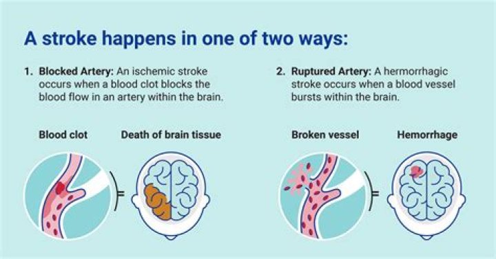 Did Joe Penny Have A Stroke? Understanding His Health Journey