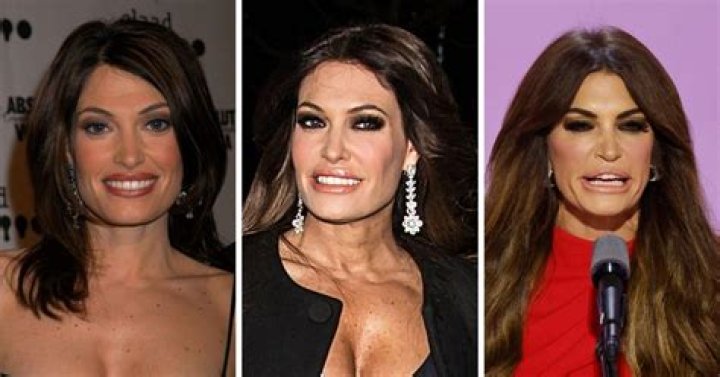 Did Kimberly Guilfoyle Have Plastic Surgery? Unveiling The Truth