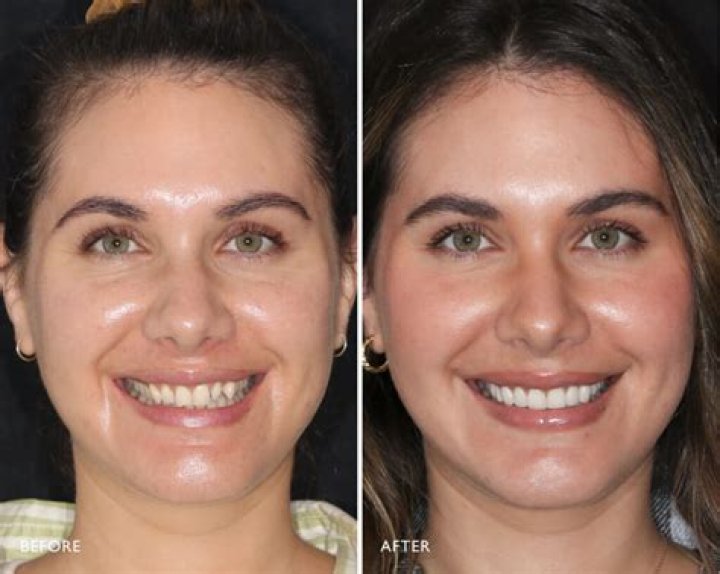 Did the Dream Home Makeover Cast Have Surgery? Veneers Before & After, Her Height, Weight & More!