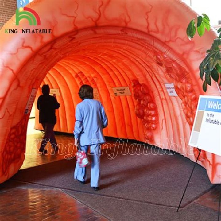 	Do you have the guts to walk through a giant inflatable colon in Fort Lauderdale?	