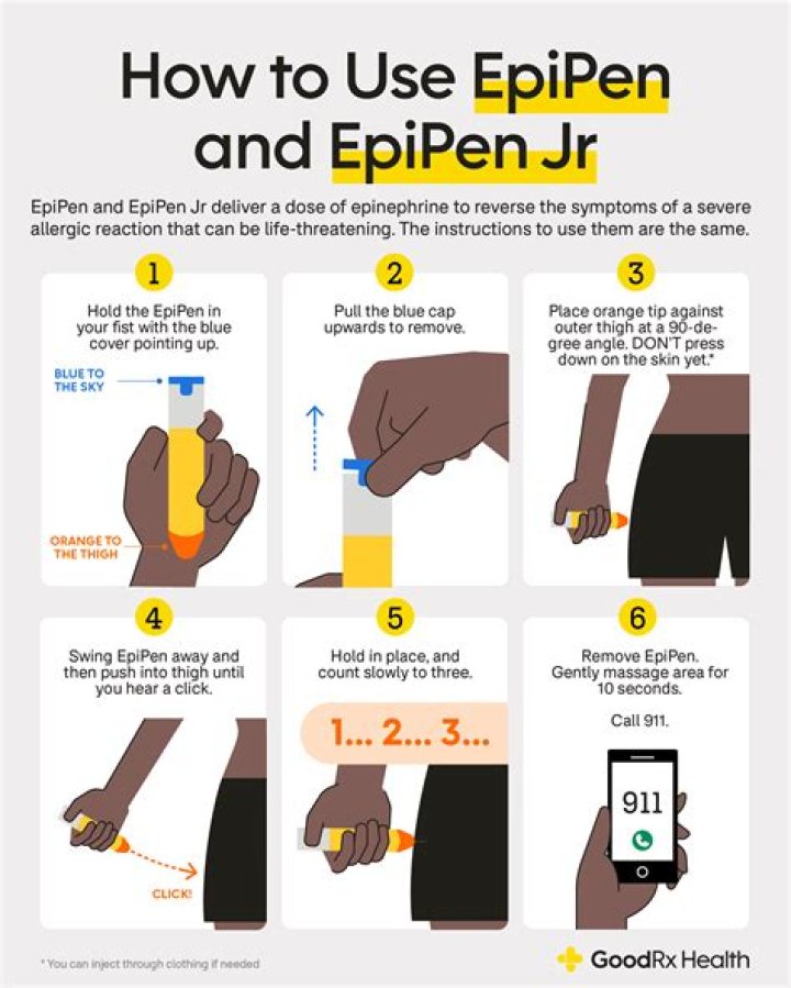 	EpiPens are oversold and overused | Opinion	
