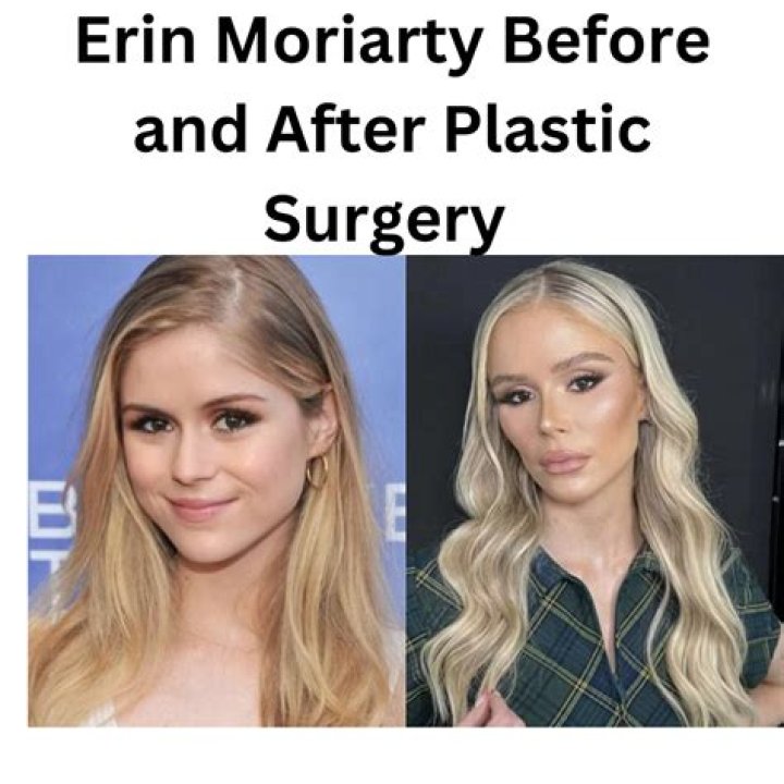 Erin Moriarty Before And After: Plastic Surgery Claims Controversy
