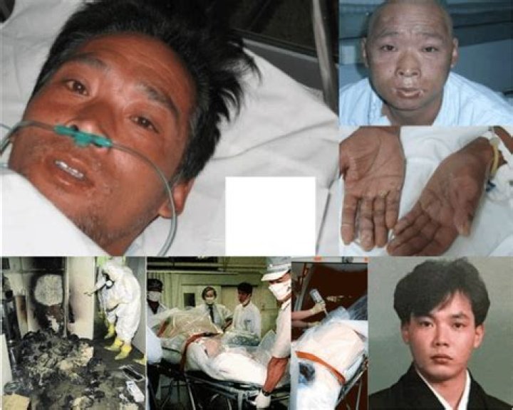 Exploring The Life And Impact Of Hisashi Ouchi: A Tragic Accident In Nuclear History