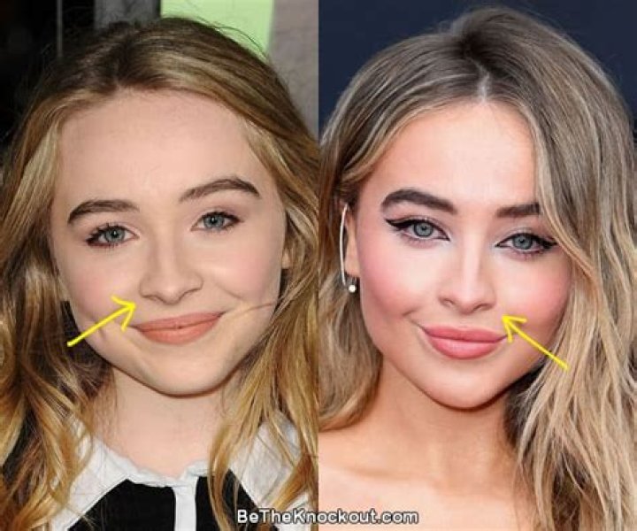 Exploring The Truth Behind Sabrina Carpenter's Nose Job: A Comprehensive Analysis