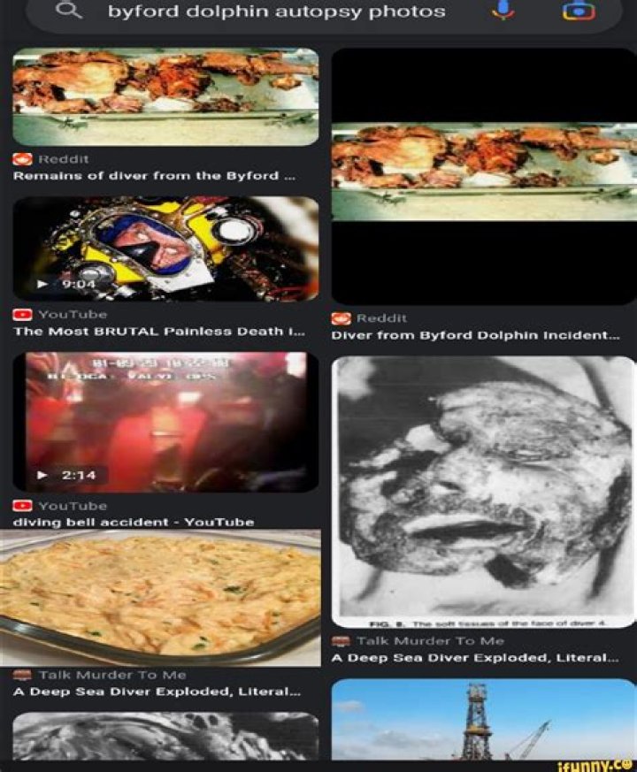 Foolios Autopsy Photos: A Deep Dive Into The Controversy And Impact