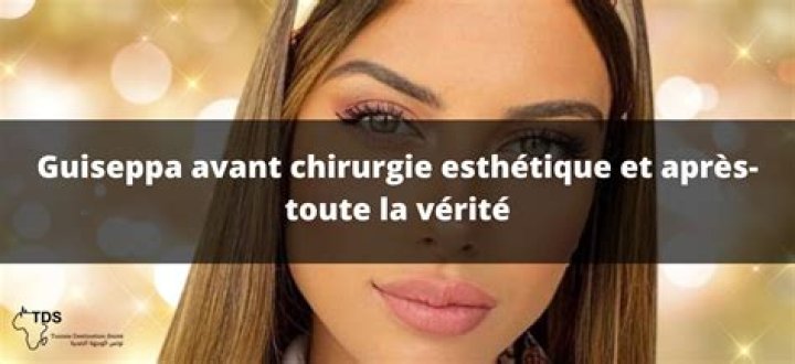   Giuseppa Avant Chirurgie