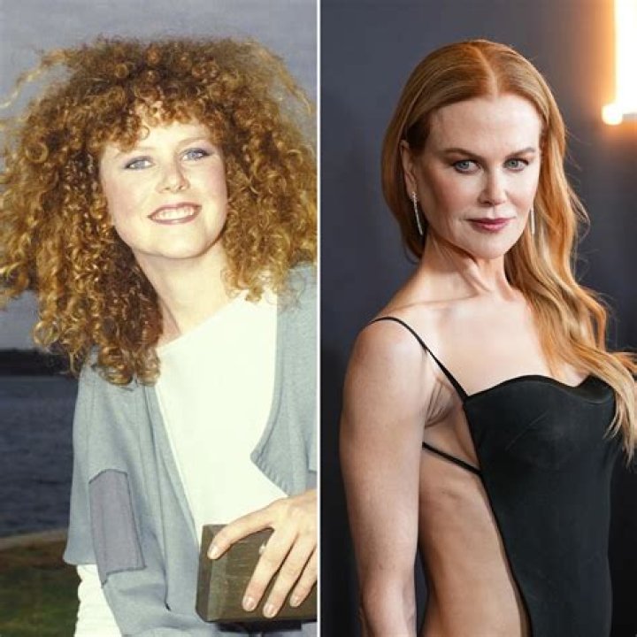 Has Nicole Kidman Had Botox? A Deep Dive Into Her Beauty Secrets
