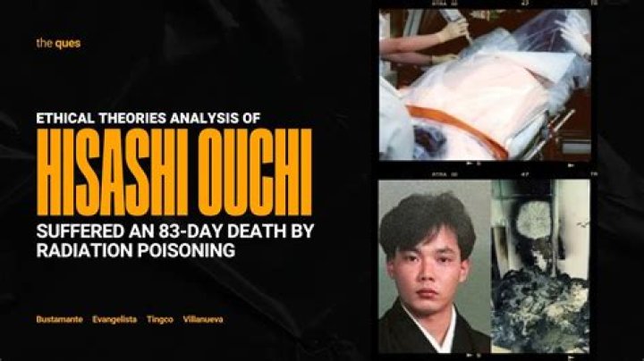 Hisashi Death Photos: Understanding The Impact And Controversy