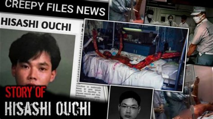 Hisashi Ouchi: The Untold Story Through Real Photos