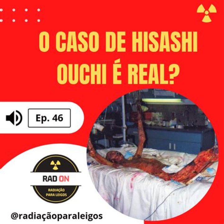 Hisashi Real Photos Day 85: Exploring The Journey Through Captivating Imagery