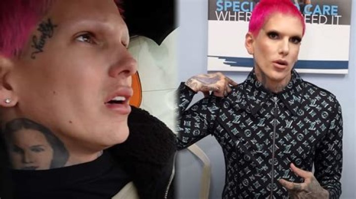 Jeffree Star finally opens up about 