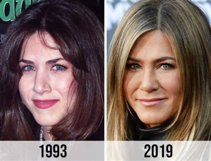 Jennifer Aniston Before Surgery