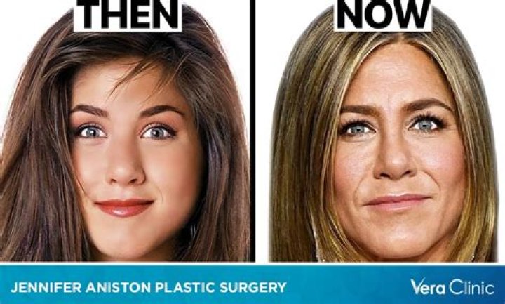 Jennifer Aniston Have Plastic Surgery