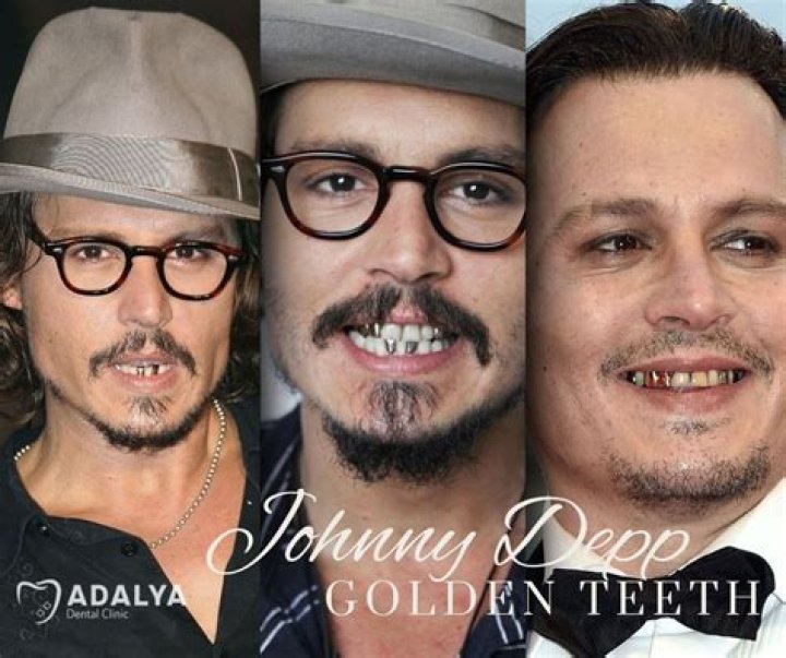 Johnny Depp Teeth 2024: A Comprehensive Look At His Iconic Smile