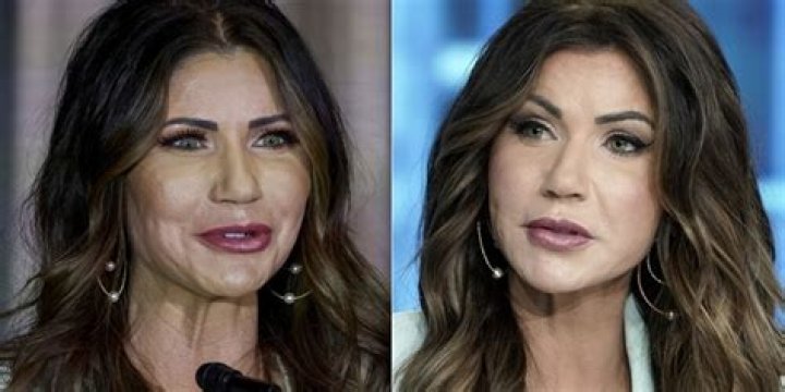 Kristi Noem Before And After: A Comprehensive Look At Her Transformation