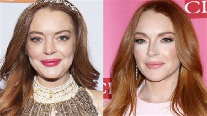 Lindsay Lohan's Plastic Surgery: Uncovering The Untold Truths And Transformations