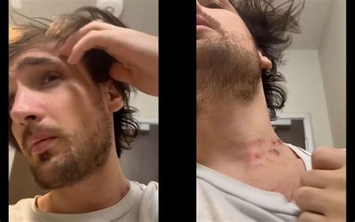 Mitch Jones Mizkif Fight, Drama: Did Latter Actually Assault Him?