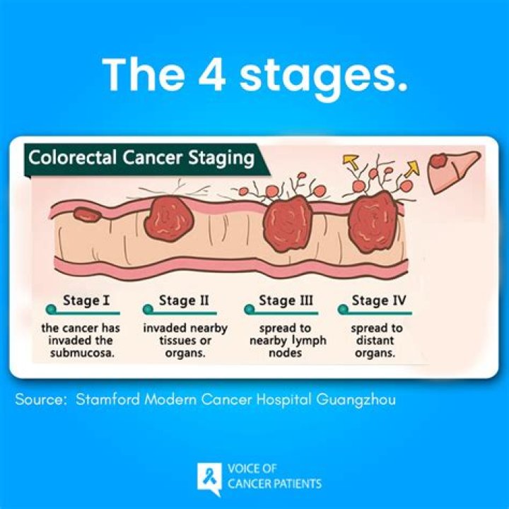 Pioneer Woman: Battling Stage 4 Colon Cancer