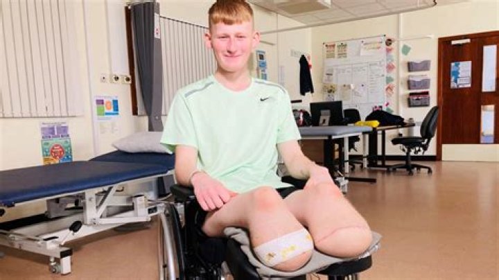 	POLICE RALLY TO BOY, 10, WHO LOSES LEG IN TRAIN ACCIDENT	
