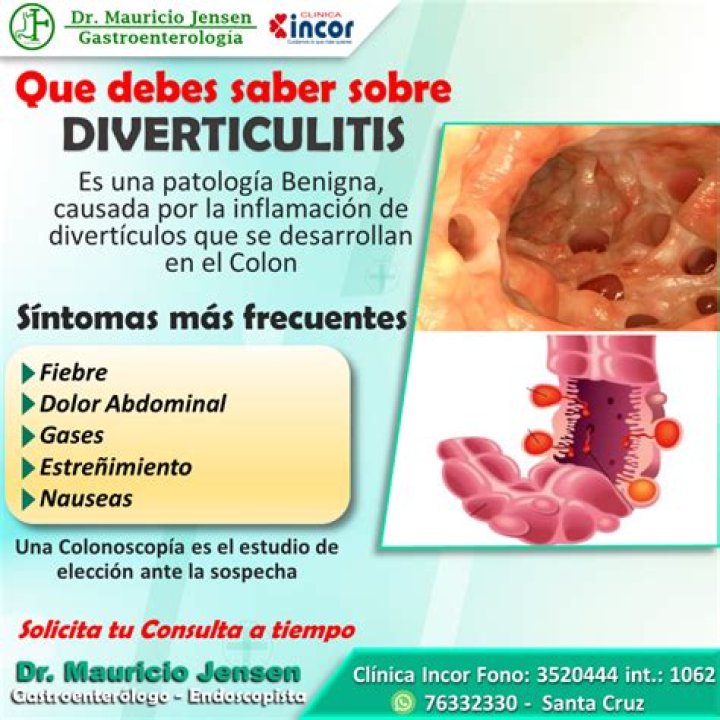 Qué es la diverticulitis: síntomas y causas