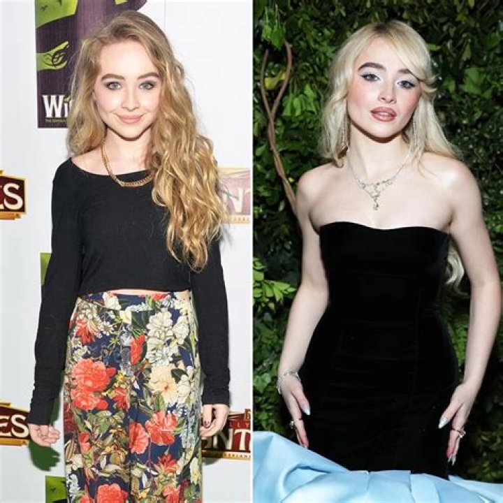 Sabrina Carpenter Nose Job: Did She Really Get Surgery?