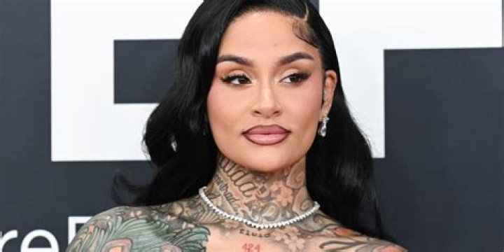 Singer Kehlani Reveals The After-effect Of Plastic Surgery