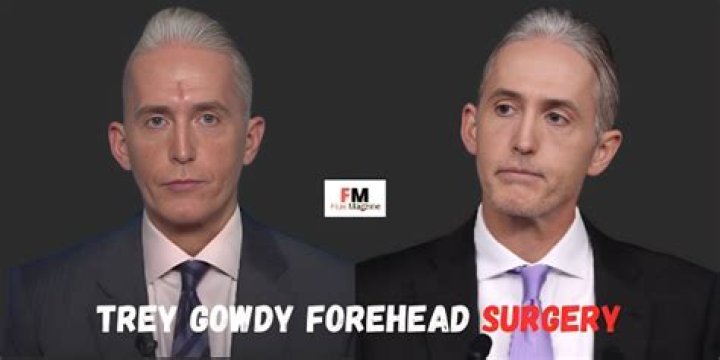 Trey Gowdy Nose Surgery: Everything You Need To Know