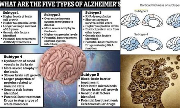 Types of dementia | Alzheimer's Society