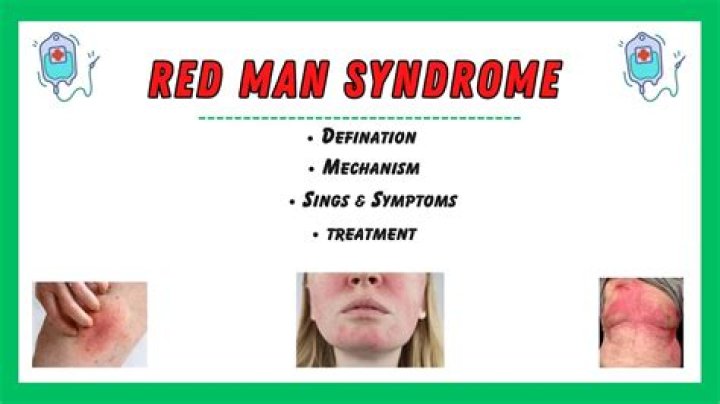 Understanding Rapper Redman's Illness: Unveiling The Health Journey