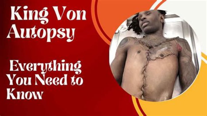 Unraveling The Mystery: Autopsie De King Von