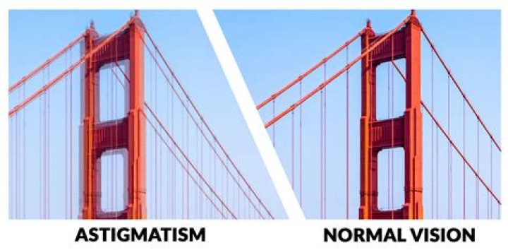 Unveiling The Secrets Of Astigmatism: Discoveries And Insights
