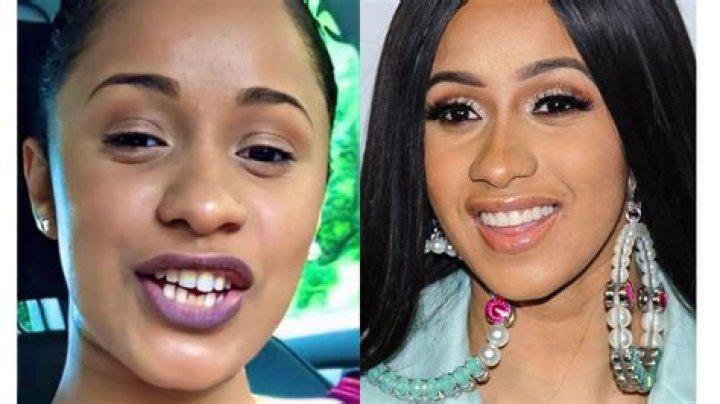 Unveiling The Smile: The Story Behind Cardi B's Teeth