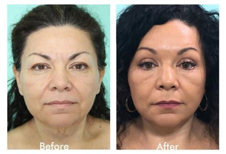 Unveiling The Truth: Discoveries And Insights About Plastic Surgery In Tijuana, Mexico