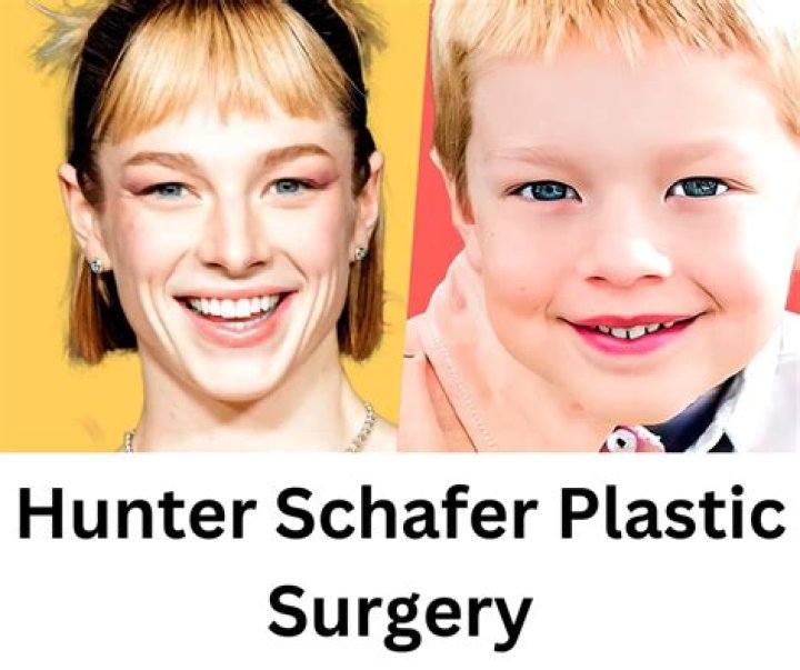 Unveiling The Truth: Has Hunter Schafer Had Surgery?
