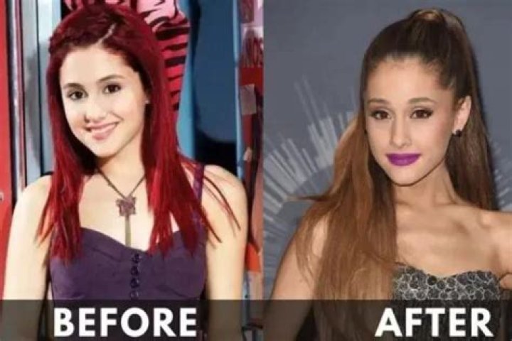 Unveiling Truths: Ariana Grande's Health Journey Explored
