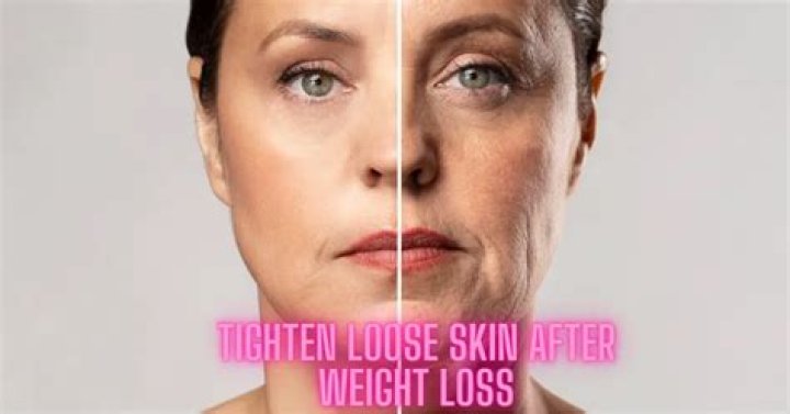 	WEIGHT-LOSS FIRM’S	
