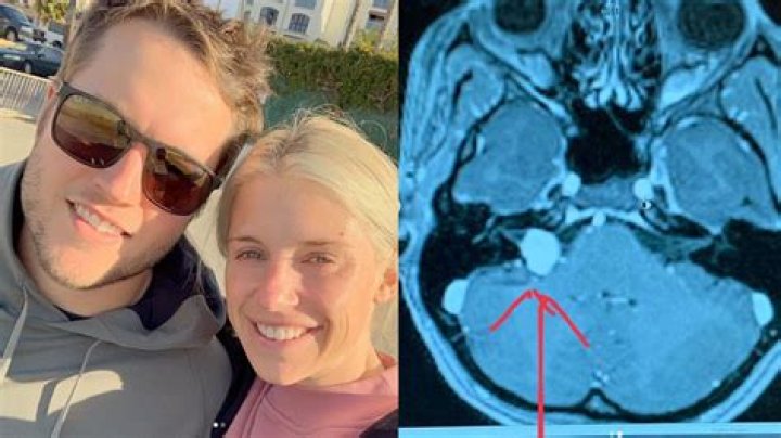 Wife of Lions quarterback Matthew Stafford has brain tumor