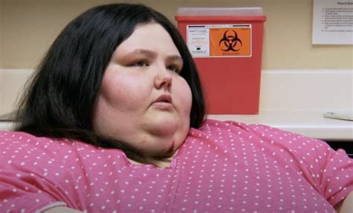 William From 600 Pound Life: A Journey Through Weight Loss And Transformation
