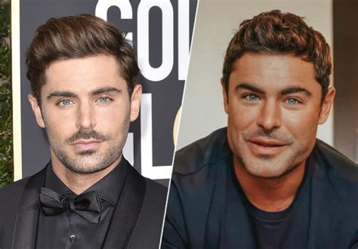 Zac Efron Chirurgie
